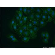 VAMP4 Rabbit Polyclonal Antibody (10738-1-AP)