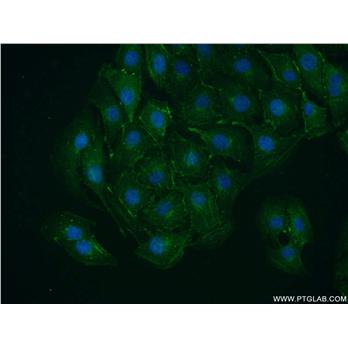 VAMP4 Rabbit Polyclonal Antibody (10738-1-AP)