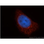 TAP1 Rabbit Polyclonal Antibody (11114-1-AP)