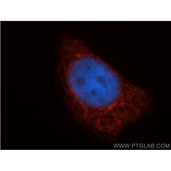 TAP1 Rabbit Polyclonal Antibody (11114-1-AP)
