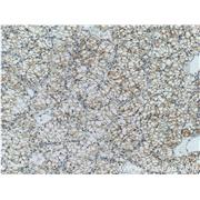 CA9 Rabbit Polyclonal Antibody (11071-1-AP)