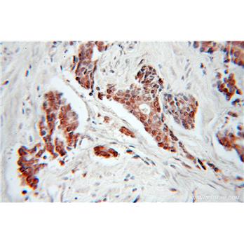 CDC34 Rabbit Polyclonal Antibody (10964-2-AP)