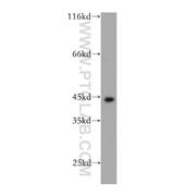 KRT19 Rabbit Polyclonal Antibody (10712-1-AP)