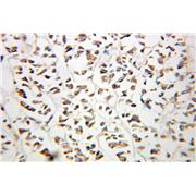 OSTF1 Rabbit Polyclonal Antibody (10671-1-AP)
