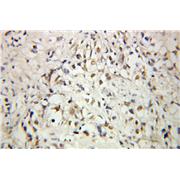C1D Rabbit Polyclonal Antibody (10711-1-AP)