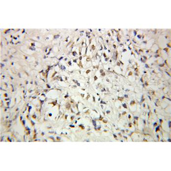 C1D Rabbit Polyclonal Antibody (10711-1-AP)