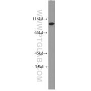 CDC27 Rabbit Polyclonal Antibody (10918-1-AP)