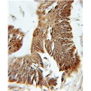 PFDN1 Rabbit Polyclonal Antibody (11033-2-AP)
