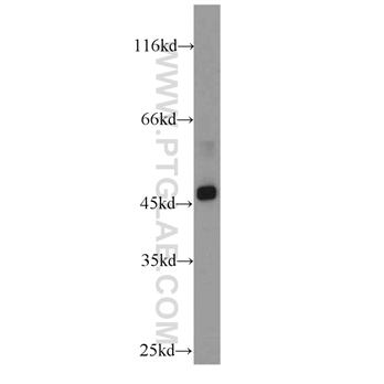 SUV39H1 Rabbit Polyclonal Antibody (10574-1-AP)