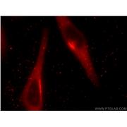 GORASP1 Rabbit Polyclonal Antibody (10747-2-AP)