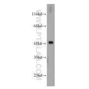 RPL3 Rabbit Polyclonal Antibody (11005-1-AP)