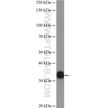HNRNPA0 Rabbit Polyclonal Antibody (10848-1-AP)