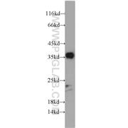 DUSP13 Rabbit Polyclonal Antibody (10909-1-AP)