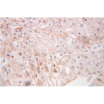 SSR1 Rabbit Polyclonal Antibody (10583-1-AP)