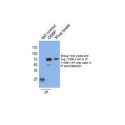 OSBP Rabbit Polyclonal Antibody (11096-1-AP)