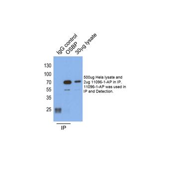 OSBP Rabbit Polyclonal Antibody (11096-1-AP)