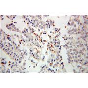 SNHG3-RCC1 Rabbit Polyclonal Antibody (10697-1-AP)