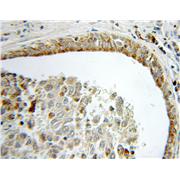 ACAA2 Rabbit Polyclonal Antibody (11111-1-AP)