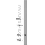 PDCD2 Rabbit Polyclonal Antibody (10725-1-AP)