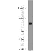 FBXO7 Rabbit Polyclonal Antibody (10696-1-AP)