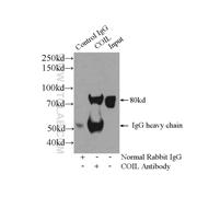 COIL Rabbit Polyclonal Antibody (10967-1-AP)
