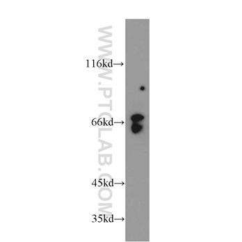 ATIC Rabbit Polyclonal Antibody (10726-1-AP)