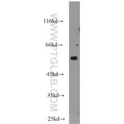 CCT3 Rabbit Polyclonal Antibody (10571-1-AP)