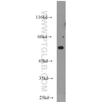 CCT3 Rabbit Polyclonal Antibody (10571-1-AP)
