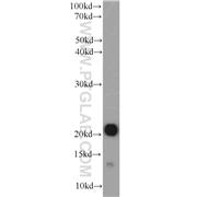 CSRP3 Rabbit Polyclonal Antibody (10721-1-AP)