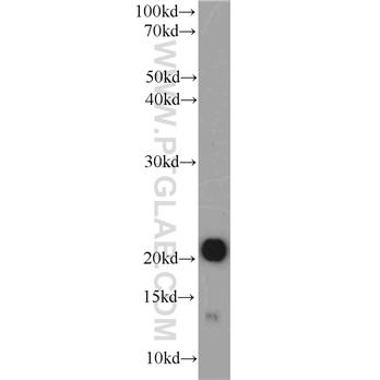 CSRP3 Rabbit Polyclonal Antibody (10721-1-AP)