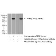 CTSF Rabbit Polyclonal Antibody (11055-1-AP)
