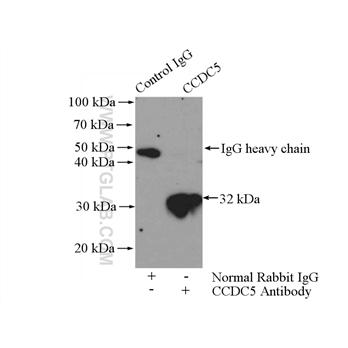 CCDC5 Rabbit Polyclonal Antibody (11094-2-AP)