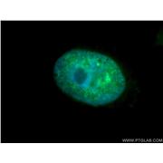 TCOF1 Rabbit Polyclonal Antibody (11003-1-AP)