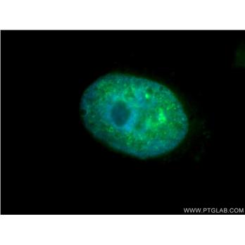 TCOF1 Rabbit Polyclonal Antibody (11003-1-AP)