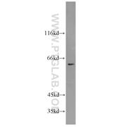SLC25A13 Rabbit Polyclonal Antibody (10789-1-AP)