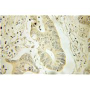 HPGD Rabbit Polyclonal Antibody (11035-1-AP)