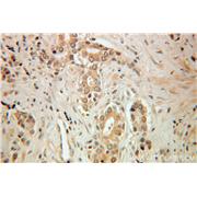 HSF2 Rabbit Polyclonal Antibody (10706-1-AP)