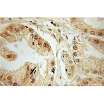 DEDD Rabbit Polyclonal Antibody (10816-1-AP)