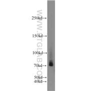 CIRH1A Rabbit Polyclonal Antibody (11057-1-AP)