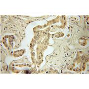PRKAA1 Rabbit Polyclonal Antibody (10929-2-AP)