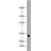 GLTP Rabbit Polyclonal Antibody (10850-1-AP)