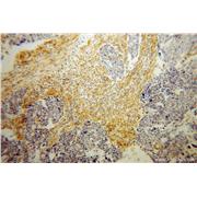 HSD17B2 Rabbit Polyclonal Antibody (10978-1-AP)