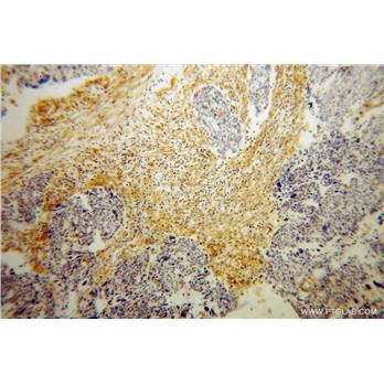 HSD17B2 Rabbit Polyclonal Antibody (10978-1-AP)