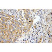 MYH9 Rabbit Polyclonal Antibody (11128-1-AP)
