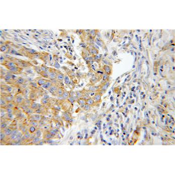 MYH9 Rabbit Polyclonal Antibody (11128-1-AP)