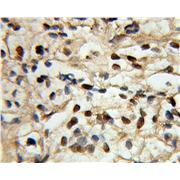 SMARCE1 Rabbit Polyclonal Antibody (10814-1-AP)