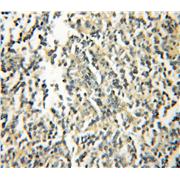 GIMAP5 Rabbit Polyclonal Antibody (11068-1-AP)