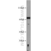 PABPC1 Rabbit Polyclonal Antibody (10970-1-AP)