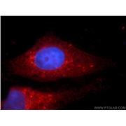 PLOD3 Rabbit Polyclonal Antibody (11027-1-AP)