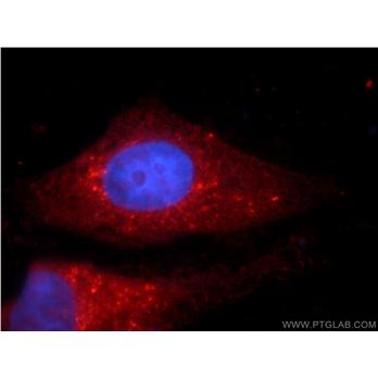 PLOD3 Rabbit Polyclonal Antibody (11027-1-AP)